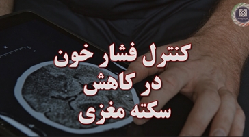 کنترل فشار خون در کاهش سکته مغزی 